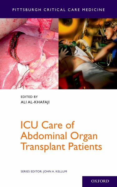 ICU Care of Abdominal Organ Transplant Patients (eBook, PDF) ICU Care of Abdominal Organ Transplant Patients (eBook, PDF)