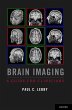 Brain Imaging (eBook, PDF) - Bild 1
