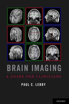 Brain Imaging (eBook, PDF) - Lebby, Paul C.