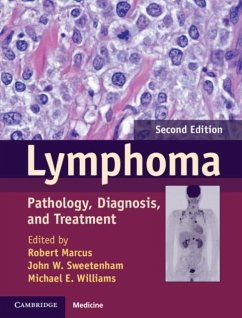 Cover Lymphoma (eBook, PDF)
