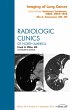 Imaging of Lung Cancer, An Issue of... - Bild 1
