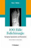 100 Fälle Fußchirurgie (eBook, PDF)