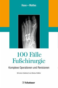 Cover 100 Fälle Fußchirurgie (eBook, PDF)