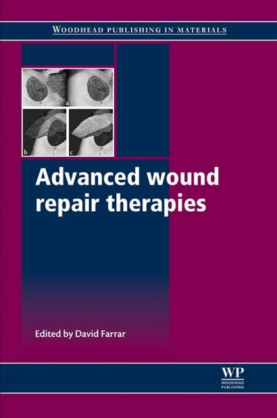 Advanced Wound Repair Therapies (eBook, ePUB) Advanced Wound Repair Therapies (eBook, ePUB)