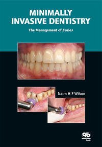 Minimally Invasive Dentistry - Nairn H. F. Wilson