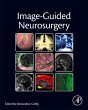 Image-Guided Neurosurgery - Bild 1