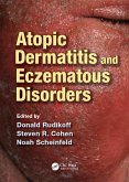 Atopic Dermatitis and Eczematous Disorders (eBook, PDF)