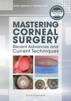 Mastering Corneal Surgery - Agarwal, Amar; John, Thomas