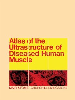 Atlas of the Ultrastructure of Diseased Human Muscle (eBook, ePUB) - Mair, W G P; Tomé, F M S