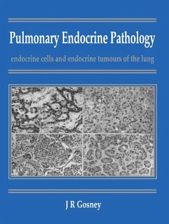 Pulmonary Endocrine Pathology (eBook, ePUB) - Gosney, John R.