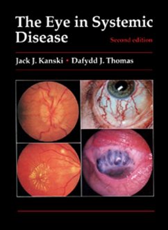 The Eye in Systemic Disease (eBook, ePUB) - Kanski, Jack J.; Thomas, Dafydd J.