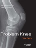 The Problem Knee (eBook, PDF)