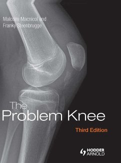 The Problem Knee (eBook, PDF) - Macnicol, Malcolm; Steenbrugge, Franky