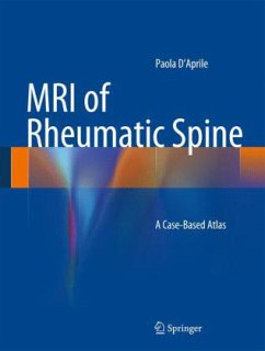 MRI of Rheumatic Spine - D Aprile, Paola