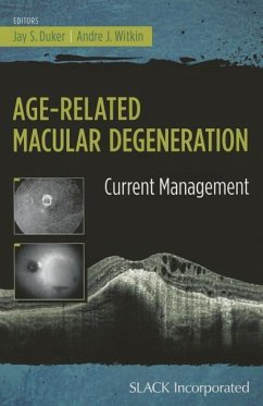 Age-Related Macular Degeneration - Duker, Jay; Witkin, Andre