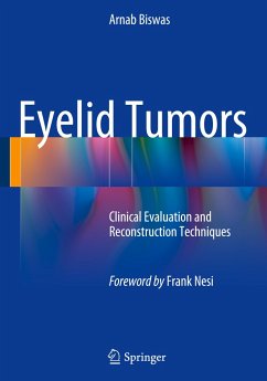 Eyelid Tumors - Biswas, Arnab