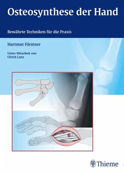 Osteosynthese der Hand (eBook, ePUB) - Förstner, Hartmut