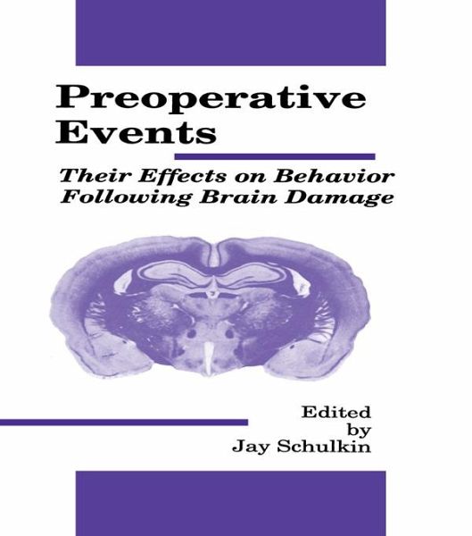 Preoperative Events (eBook, PDF) Preoperative Events (eBook, PDF)