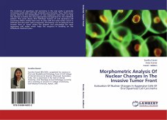 Morphometric Analysis Of Nuclear Changes In The Invasive Tumor Front - Daniel, Sunitha;Kumar, Kiran;Hallikeri, Kaveri