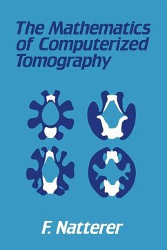 The Mathematics of Computerized Tomography - Natterer, F.