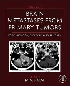 Brain Metastases from Primary Tumors Volume 1