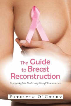 The Guide to Breast Reconstruction - O'Grady, Patricia