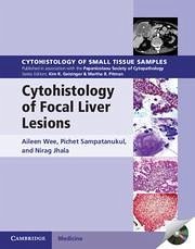 Cytohistology of Focal Liver Lesions - Wee, Aileen; Sampatanukul, Pichet; Jhala, Nirag