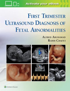 First Trimester Ultrasound Diagnosis of Fetal Abnormalities - Abuhamad, Alfred; Chaoui, Rabih