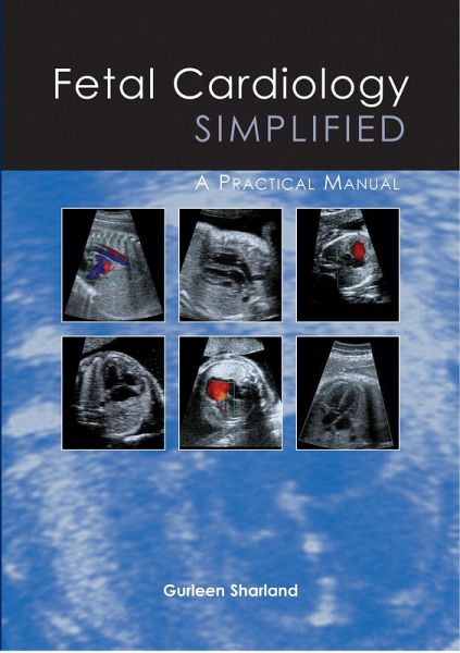 Fetal Cardiology Simplified (eBook, PDF)