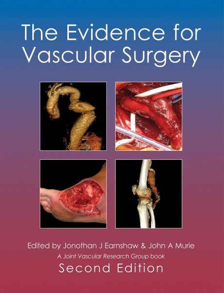 Evidence for Vascular Surgery; second edition (eBook, PDF) Evidence for Vascular Surgery; second edition (eBook, PDF)