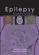 Epilepsy Simplified (eBook, PDF) - Bild 1