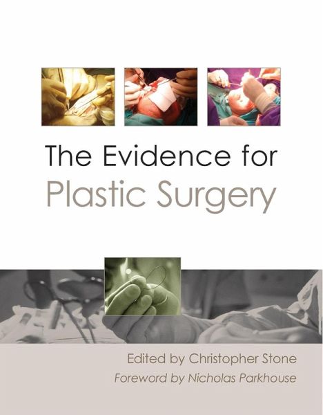 Evidence for Plastic Surgery (eBook, PDF) Evidence for Plastic Surgery (eBook, PDF)