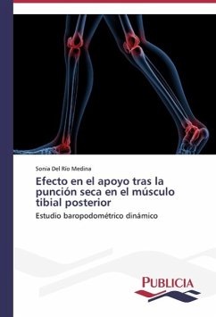 Efecto en el apoyo tras la punción seca en el músculo tibial posterior - Del Río Medina, Sonia