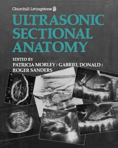 Cover Ultrasonic Sectional Anatomy (eBook, ePUB)