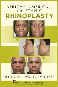 Cover African-American and Ethnic Rhinoplasty (eBook, ePUB)