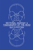 Sectional Anatomy and Tomography of the Head (eBook, ePUB)