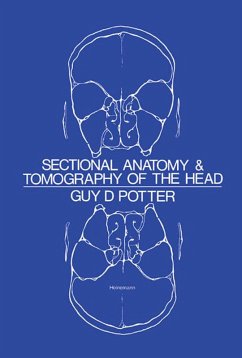 Sectional Anatomy and Tomography of the Head (eBook, ePUB) - Potter, Guy D.