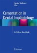 Cementation in Dental Implantology - Bild 1