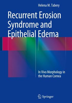 Recurrent Erosion Syndrome and Epithelial Edema - Tabery, Helena M.
