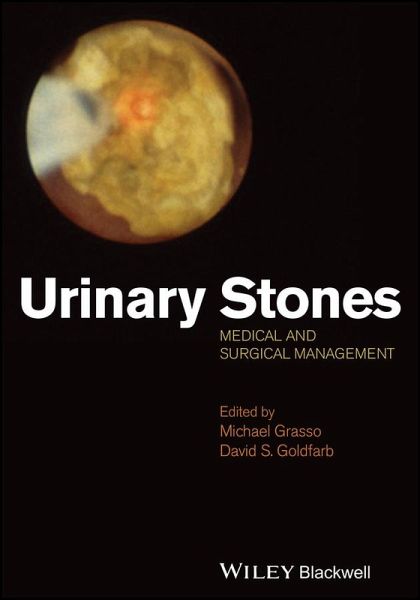 Urinary Stones (eBook, PDF)