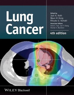 Lung Cancer (eBook, ePUB)