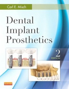 Dental Implant Prosthetics - Misch, Carl E.