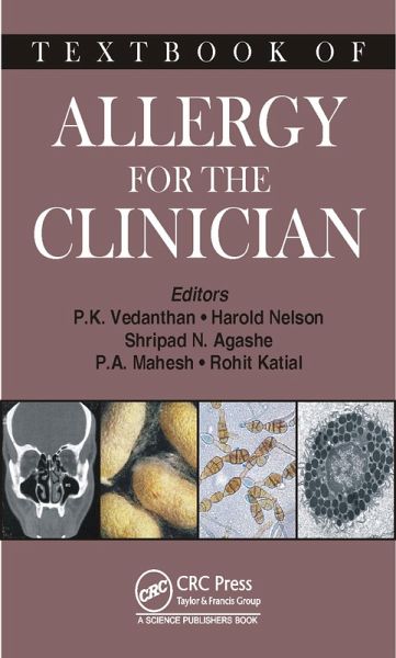 Textbook of Allergy for the Clinician (eBook, PDF) Textbook of Allergy for the Clinician (eBook, PDF)