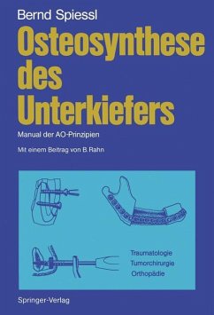 Osteosynthese des Unterkiefers - Spiessl, Bernd