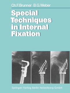 Special Techniques in Internal Fixation - Brunner, C. F.; Weber, B. G.