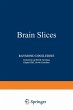 Brain Slices - Bild 1