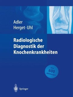 Radiologische Diagnostik der Knochenkrankheiten - Adler, Claus-Peter;Herget, Georg;Uhl, Markus