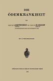 Die Ödemkrankheit