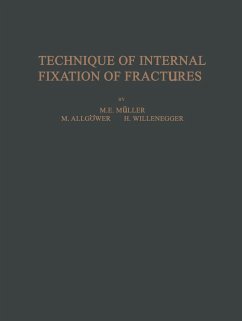 Technique of Internal Fixation of Fractures - Müller, M. E.;Bandi, W.;Bloch, H. R.