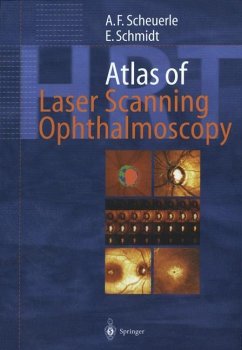 Atlas of Laser Scanning Ophthalmoscopy - Scheuerle, Alexander Friedrich;Schmidt, Eckart